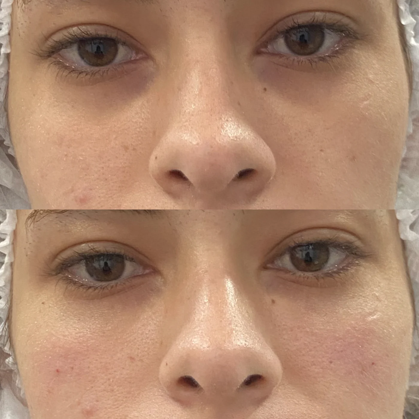 Antes e depois, textura e viço, caso publicado pela Dra. Flávia