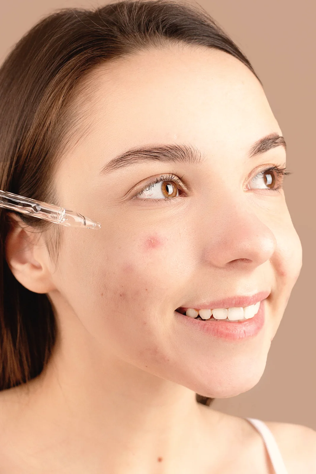 Mulher aplicando sérum com conta-gotas na pele com acne